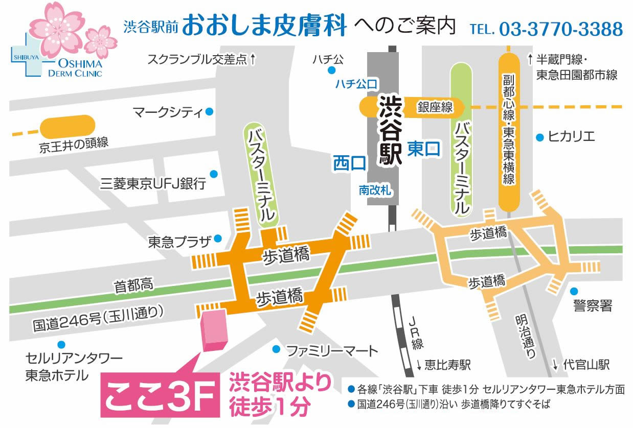 アクセス
