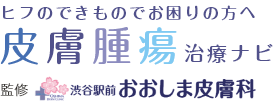 ヒフのできものでお困りの方へ 皮膚腫瘍治療ナビ 監修 渋谷駅前おおしま皮膚科